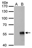 Anti-Influenza A virus Nucleoprotein antibody [GT778] used in Western Blot (WB). GTX629544
